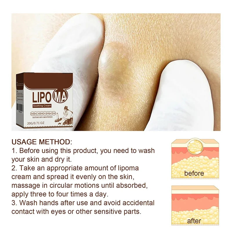 LipoEase™ Fat Cream