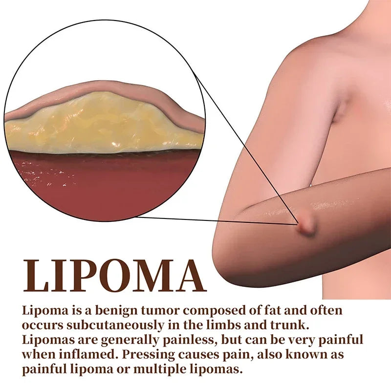 LipoEase™ Fat Cream