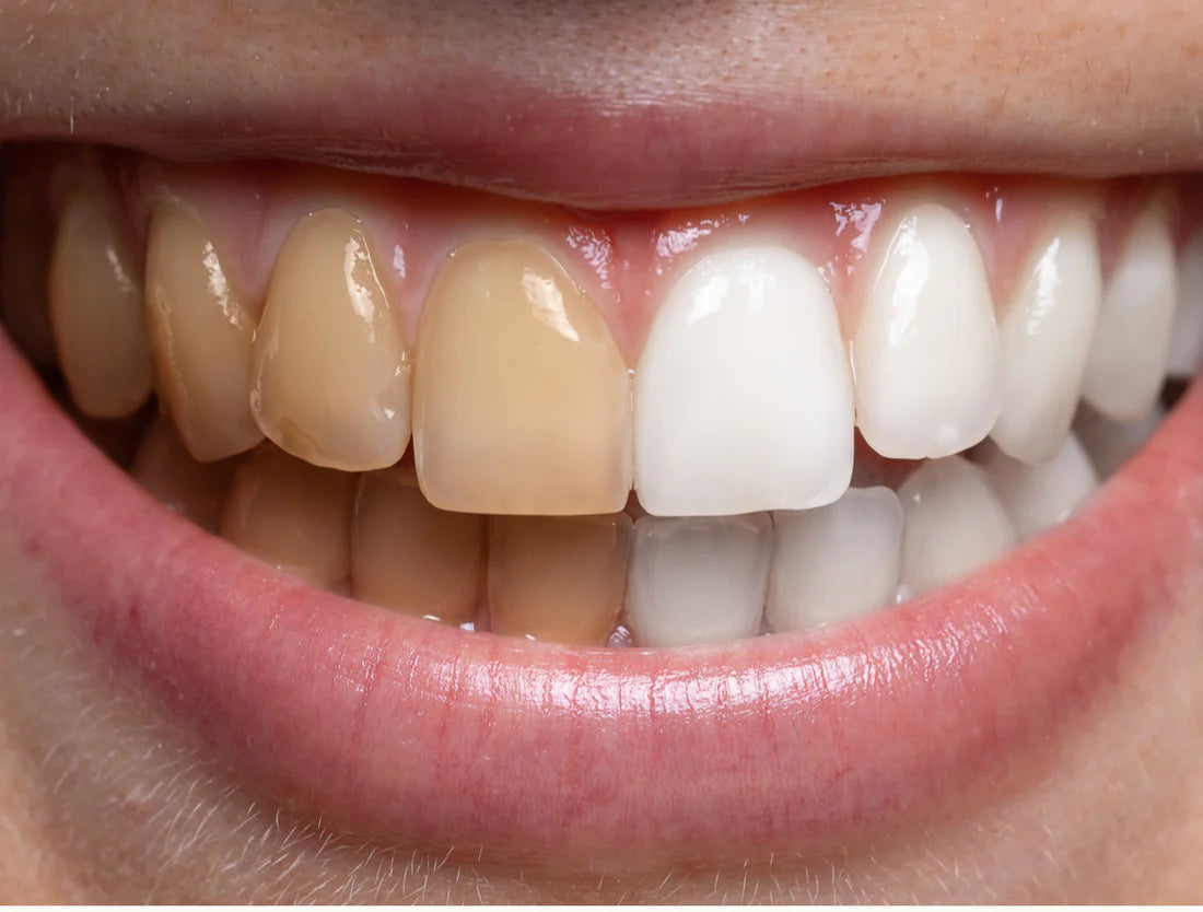 OralPro™- Dental Scaler Toothbrush