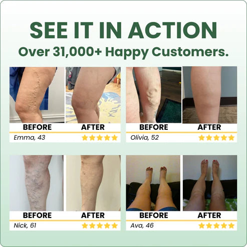 Herbal™ Miracle Balm
