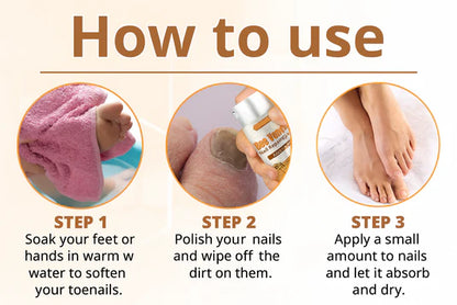 Bee Venom Nail Fungus