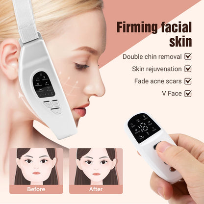 ContourFlex™ V-Lift Pro