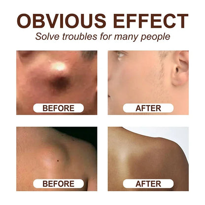 LipoEase™ Fat Cream