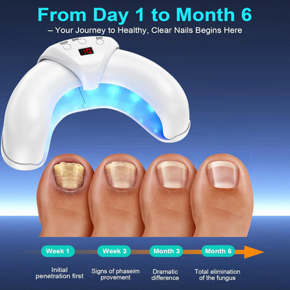 Nailux Pro™ | Clear Nails. Zero Hassle. Just Light.