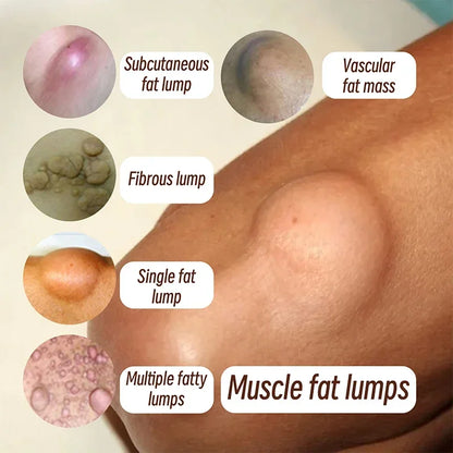 LipoEase™ Fat Cream