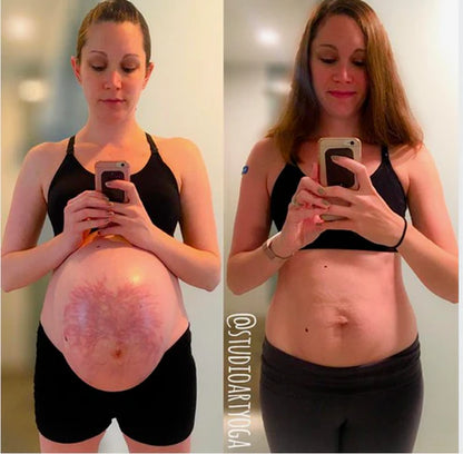 DermaLuv™ - Anti wrinkle/Stretch Marks Patch