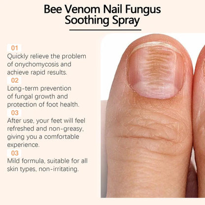Bee Venom Nail Fungus