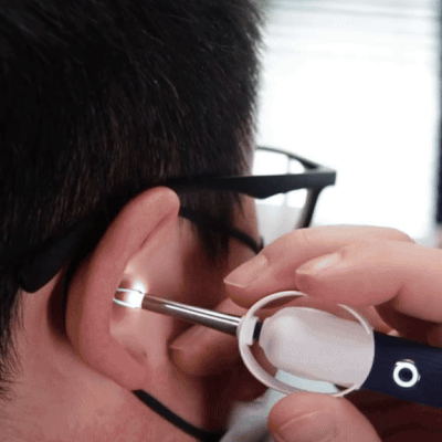 Bebird EarSight Plus™